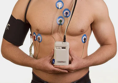 Суточное мониторирование электрокардиограммы (ЭКГ) и/или артериального давления (АД).
