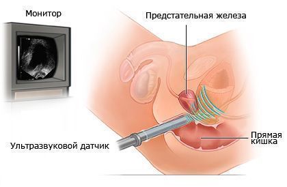 Лечебный массаж простаты (1 сеанс) в Медицинском центре Альфа Технологии Новосибирск